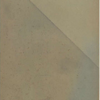 L' angine ulcéro-membraneuse à bacilles fusiformes et spirilles (Angine de Vincent) : à propos d'une observation récente de cette variété d'angine